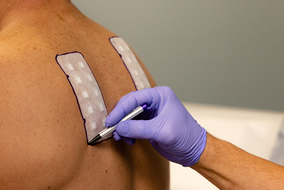 Patch Testing - Dermatology Associates of Lincoln